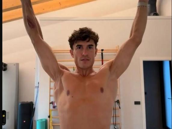 Marc Marquez mostra la spalla destra operata 7 volte: la foto su Instagram fa impressione