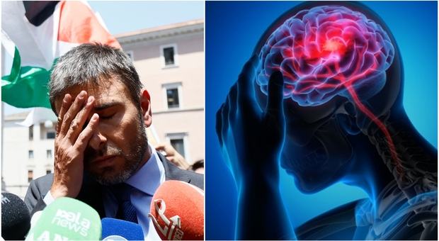 Di Battista e i dolori alla testa, la neurologa: «Ecco le possibili cause». Sintomi e quando la cefalea deve preoccupare