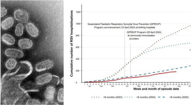 Influenza settembre, Bassetti: «Virus più aggressivo, boom di casi gravi come lo scorso anno». I 7 sintomi e cosa dobbiamo aspettarci