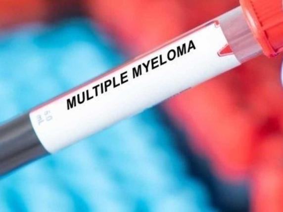 Mieloma multiplo, più progressi negli ultimi cinque anni che nei 25 precedenti: quali sono le cure innovative efficaci